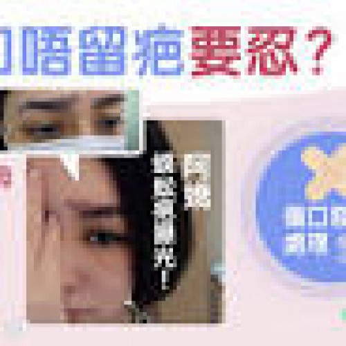 阿嬌眉骨蜈蚣疤｜傷口防發炎留疤切記3件事戒燒鵝？幾時濕水？